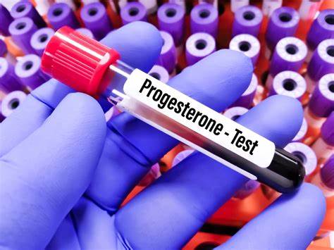 Progesterone Test