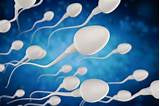 Semen Analysis